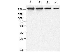 Western Blotting (WB) image for anti-Mechanistic Target of Rapamycin (serine/threonine Kinase) (mTOR) antibody (ABIN2665281) (MTOR Antikörper)