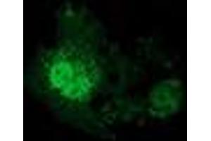 Anti-EIF4E2 mouse monoclonal antibody (ABIN2454244) immunofluorescent staining of COS7 cells transiently transfected by pCMV6-ENTRY EIF4E2 (RC201391). (EIF4E2 Antikörper)