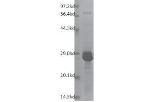 Western Blotting (WB) image for Tripartite Motif Containing 28 (TRIM28) (AA 624-811) protein (His tag,DYKDDDDK Tag) (ABIN2669689)