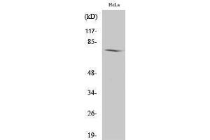 Western Blotting (WB) image for anti-Amphiphysin (AMPH) (Internal Region) antibody (ABIN3173773) (Amphiphysin Antikörper  (Internal Region))