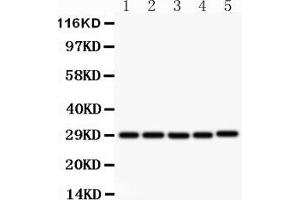 Western blot analysis of sCD40L using anti- sCD40L antibody .