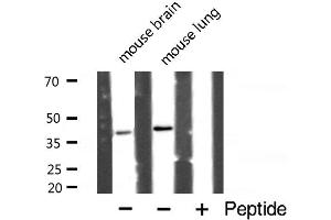 Western blot analysis of POLB expression in various lysates (POLB Antikörper  (C-Term))