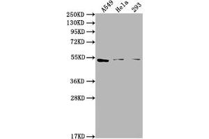 Western Blot Positive WB detected in: A549 whole cell lysate, Hela whole cell lysate, 293 whole cell lysate All lanes: CNR1 antibody at 1:2000 Secondary Goat polyclonal to rabbit IgG at 1/50000 dilution Predicted band size: 53, 46, 50 kDa Observed band size: 53 kDa (CNR1 Antikörper  (AA 1-116))