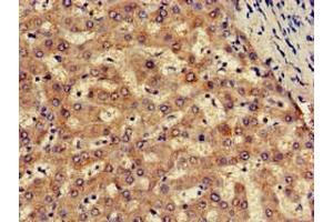 Immunohistochemistry of paraffin-embedded human liver tissue using ABIN7170102 at dilution of 1:100 (SLC13A5 Antikörper  (AA 156-204))