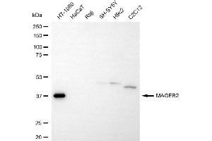 Western blotting analysis using MAGEB2 antibody (ABIN7799358). (MAGEB2 Antikörper)