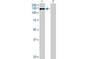 Western Blot analysis of TUBGCP5 expression in transfected 293T cell line by TUBGCP5 MaxPab polyclonal antibody. (TUBGCP5 Antikörper  (AA 1-1024))
