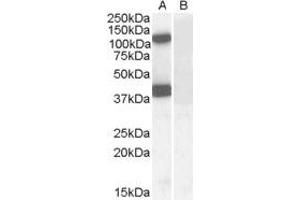 ABIN238594 (0. (EPB41L2 Antikörper  (Internal Region))