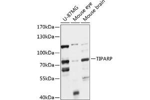 Western blot analysis of extracts of various cell lines, using TIPARP antibody (ABIN7270752) at 1:1000 dilution. (Tiparp Antikörper  (AA 1-320))