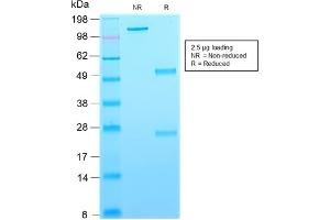 SDS-PAGE Analysis Purified CD63-Monospecific Mouse Recombinant Monoclonal Antibody (rMX-49. (Rekombinanter CD63 Antikörper)