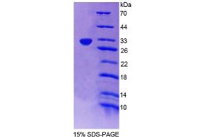 SDS-PAGE analysis of Rat CAR Protein. (NR1I3 Protein)