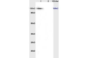 L1 rat thyriod lysates L2 rat brain lysates probed with Anti KIF11/Eg5/TRIP5 Polyclonal Antibody, Unconjugated (ABIN872373) at 1:200 overnight at 4 °C. (K11 (AA 351-450) Antikörper)