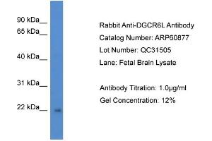 Western Blotting (WB) image for anti-DiGeorge Syndrome Critical Region Gene 6-Like (DGCR6L) (C-Term) antibody (ABIN2788616) (DGCR6L Antikörper  (C-Term))