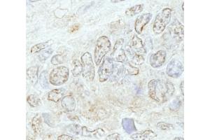 Immunohistochemistry (IHC) image for anti-Methyltransferase Like 3 (METTL3) (AA 1-50) antibody (ABIN7448668) (METTL3 Antikörper  (AA 1-50))