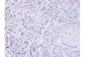 IHC-P Image Immunohistochemical analysis of paraffin-embedded Cal27 Xenograft, using ZNF165, antibody at 1:100 dilution. (ZNF165 Antikörper)