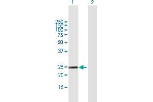 Western Blot analysis of FGA expression in transfected 293T cell line by FGA MaxPab polyclonal antibody. (FGA Antikörper  (AA 1-218))