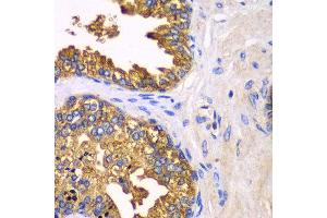 Immunohistochemistry of paraffin-embedded human prostate using SRP19 antibody at dilution of 1:100 (x40 lens). (SRP19 Antikörper)