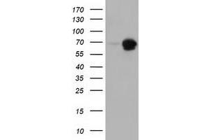 Western Blotting (WB) image for anti-Adenylate Kinase 5 (AK5) antibody (ABIN1496537) (Adenylate Kinase 5 Antikörper)