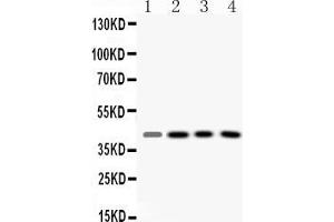 Western blot analysis of VASP expression in rat liver extract ( Lane 1), mouse kidney extract ( Lane 2), HELA whole cell lysates ( Lane 3) and HEPG2 whole cell lysates ( Lane 4).