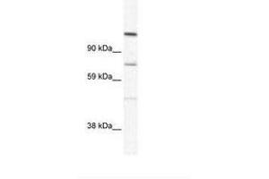 Image no. 1 for anti-Ras Association and DIL Domains (Radil) (AA 916-965) antibody (ABIN305634)