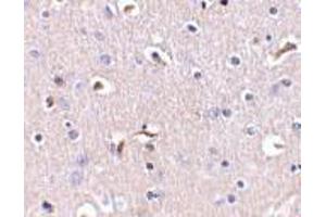 Immunohistochemistry (Paraffin-embedded Sections) (IHC (p)) image for anti-Anterior Pharynx Defective 1 Homolog A (C. Elegans) (APH1A) (Middle Region) antibody (ABIN499309)
