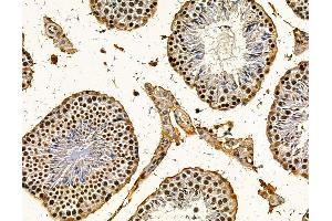 ABIN7095767 and ABIN7099829 at 1/100 staining mouse testis tissue by IHC-P. (RBM25 Antikörper)