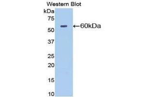 Western Blotting (WB) image for anti-5'-Nucleotidase, Ecto (CD73) (NT5E) (AA 29-550) antibody (ABIN1077721) (CD73 Antikörper  (AA 29-550))