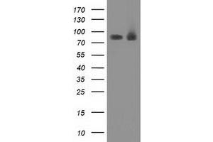 Western Blotting (WB) image for anti-Protein Kinase C, epsilon (PRKCE) antibody (ABIN1500231) (PKC epsilon Antikörper)