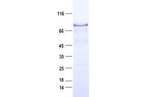 Validation with Western Blot