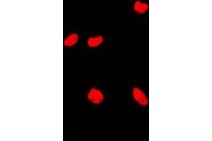 Immunofluorescent analysis of KAT7 staining in MCF7 cells. (MYST2 Antikörper  (Center))