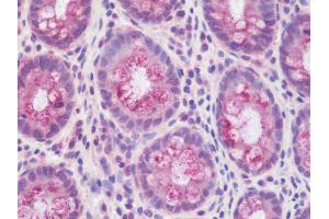 Anti-EFNB2 / Ephrin B2 antibody IHC staining of human colon.