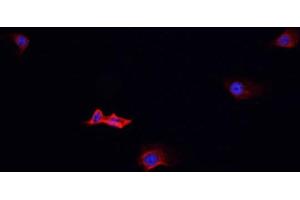 ABIN6268994 staining Jurkat cells by IF/ICC. (PSGR Antikörper  (Internal Region))