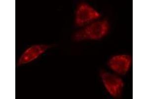 ABIN6275697 staining  A549 cells by IF/ICC. (SLC30A4 Antikörper  (Internal Region))