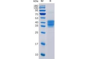 Human CD52 Protein, mFc Tag on SDS-PAGE under reducing condition.