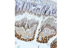IHC analysis of EIF4G1 using anti-EIF4G1 antibody (ABIN7601860).