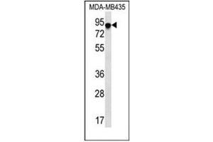 Western blot analysis of FYB Antibody (C-term) Cat. (FYB Antikörper  (C-Term))