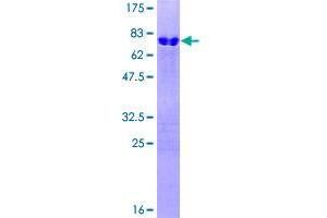 Image no. 1 for LIM Homeobox Transcription Factor 1, beta (LMX1B) (AA 1-372) protein (GST tag) (ABIN1309533)