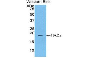 Western Blotting (WB) image for anti-Collagen, Type VIII, alpha 1 (COL8A1) (AA 590-744) antibody (APC) (ABIN1858463)