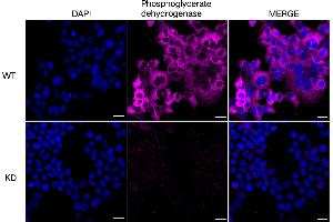 Immunocytochemical staining of HeLa cells using Phosphoglycerate dehydrogenase antibody (ABIN7799808), 1:1,000), Top panel: wild-type (WT), Bottom panal: Phosphoglycerate dehydrogenase shRNA knockdown (KD). (PHGDH Antikörper)