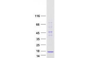 Validation with Western Blot (SNRPD2 Protein (Transcript Variant 1) (Myc-DYKDDDDK Tag))