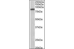 Staining of Human Substantia nigra lysate (35µg protein in RIPA buffer) using SLC6A3 antibody at 1 µg/ml. (SLC6A3 Antikörper  (Internal Region))