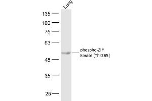 Mouse lung lysates probed with ZIP Kinase (Thr265) Polyclonal Antibody, Unconjugated  at 1:300 dilution and 4˚C overnight incubation. (DAPK3 Antikörper  (pThr265))