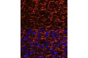 Immunofluorescence analysis of mouse brain cells using PLP1 Rabbit pAb (ABIN7269724) at dilution of 1:100 (40x lens). (PLP1 Antikörper  (AA 145-210))