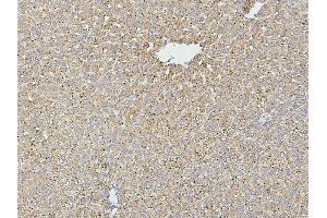 IHC analysis of HSPD1 using anti-HSPD1 antibody (ABIN7600976).