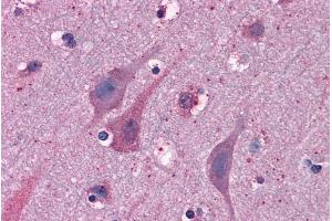 Immunohistochemistry (IHC) image for anti-Myosin VIIA and Rab Interacting Protein (MYRIP) (C-Term) antibody (ABIN185041)