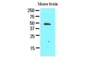 The extracts of mouse brain (50 ug) were resolved by SDS-PAGE, transferred to nitrocellulose membrane and probed with anti-human GAS7 (1:500). (GAS7 Antikörper  (AA 1-416))