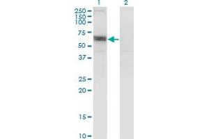 Western Blot analysis of SLC6A16 expression in transfected 293T cell line by SLC6A16 monoclonal antibody (M13), clone 2E5.
