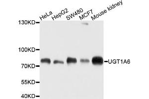 Western blot analysis of extracts of various cell lines, using UGT1A6 antibody (ABIN4905553) at 1:1000 dilution. (UGT1A6 Antikörper)