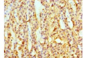 Immunohistochemistry of paraffin-embedded human adrenal gland tissue using ABIN7145594 at dilution of 1:100