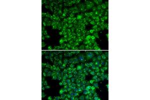 Immunofluorescence analysis of U20S cell using LYZL6 antibody. (LYZL6 Antikörper)