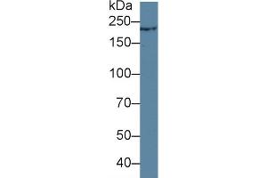 Detection of TCHH in Rat Skin lysate using Polyclonal Antibody to Trichohyalin (TCHH) (Trichohyalin Antikörper  (AA 1851-1943))